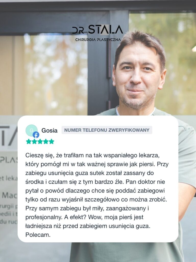 Maciej Stala Efekty przed i po (11)