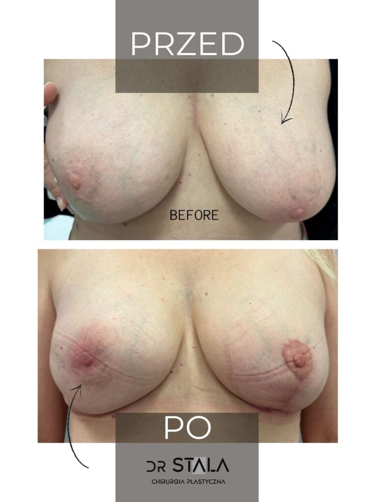 Maciej Stala Efekty przed i po (2)